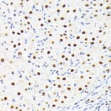 Immunohistochemistry - Anti-SPT5 Antibody [ARC2380] (A308173) - Antibodies.com