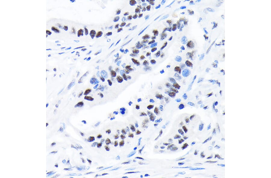 Immunohistochemistry - Anti-SPT5 Antibody [ARC2380] (A308173) - Antibodies.com