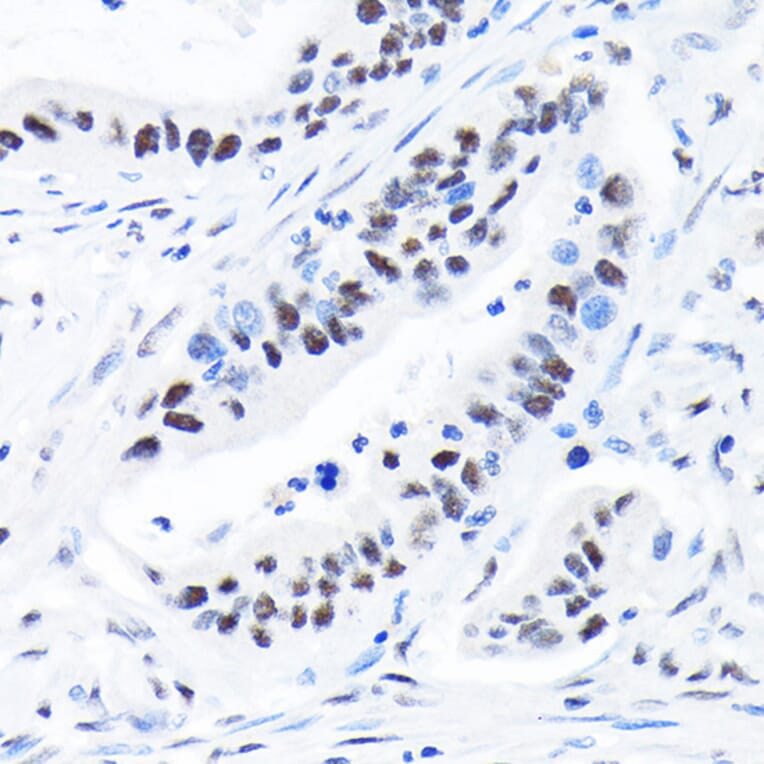 Immunohistochemistry - Anti-SPT5 Antibody [ARC2380] (A308173) - Antibodies.com