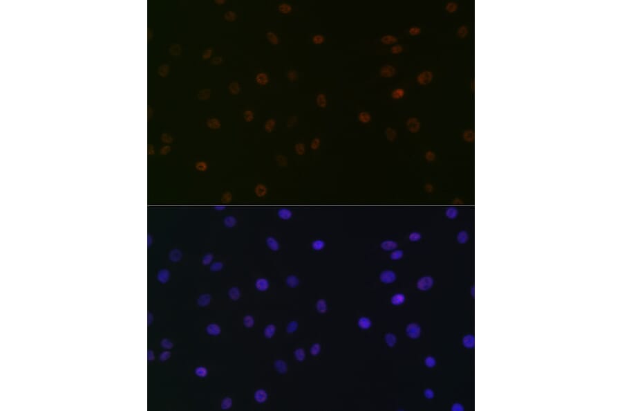 Immunofluorescence - Anti-SPT5 Antibody [ARC2380] (A308173) - Antibodies.com