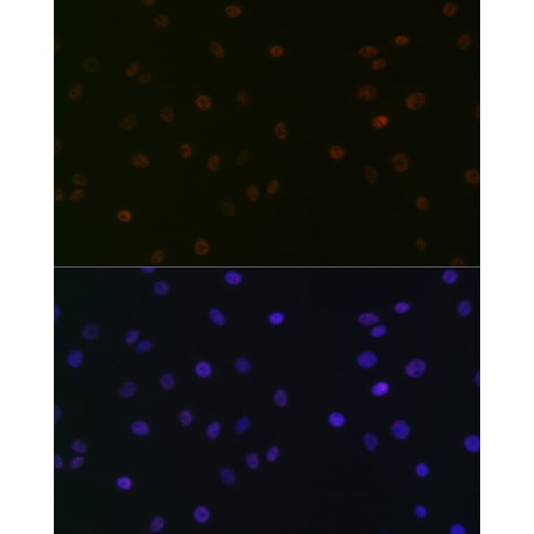 Immunofluorescence - Anti-SPT5 Antibody [ARC2380] (A308173) - Antibodies.com