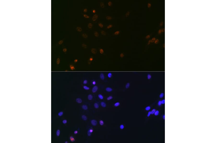 Immunofluorescence - Anti-SPT5 Antibody [ARC2380] (A308173) - Antibodies.com