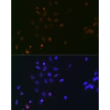 Immunofluorescence - Anti-SPT5 Antibody [ARC2380] (A308173) - Antibodies.com