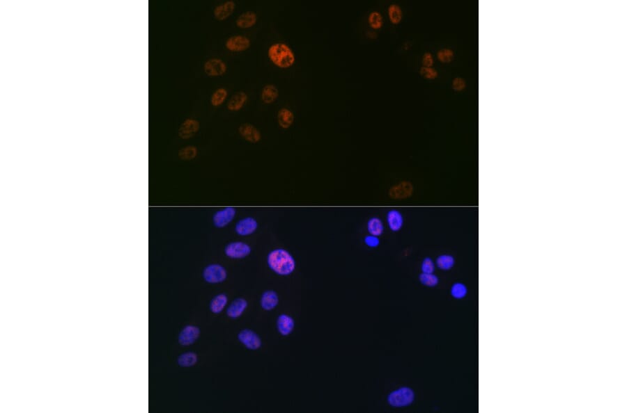 Immunofluorescence - Anti-SPT5 Antibody [ARC2380] (A308173) - Antibodies.com