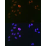Immunofluorescence - Anti-SPT5 Antibody [ARC2380] (A308173) - Antibodies.com