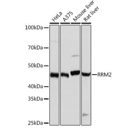 Western Blot - Anti-RRM2 Antibody [ARC0775] (A308175) - Antibodies.com