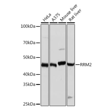 Western Blot - Anti-RRM2 Antibody [ARC0775] (A308175) - Antibodies.com