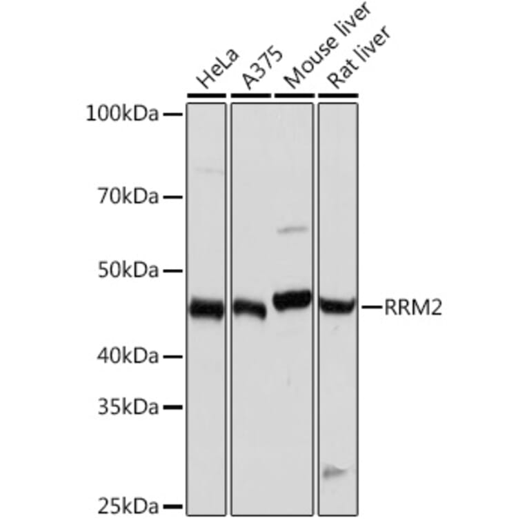 Western Blot - Anti-RRM2 Antibody [ARC0775] (A308175) - Antibodies.com