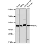 Western Blot - Anti-RRM2 Antibody [ARC0775] (A308175) - Antibodies.com