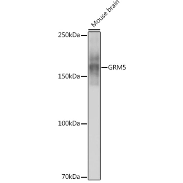 Western Blot - Anti-Metabotropic Glutamate Receptor 5 Antibody [ARC0250] (A308176) - Antibodies.com