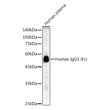 Western Blot - Anti-Human IgG Antibody [ARC53385] (A308177) - Antibodies.com