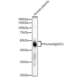 Western Blot - Anti-Human IgG Antibody [ARC53376] (A308178) - Antibodies.com