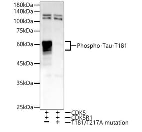 Western Blot - Anti-Tau (phospho Thr181) Antibody (A308181) - Antibodies.com