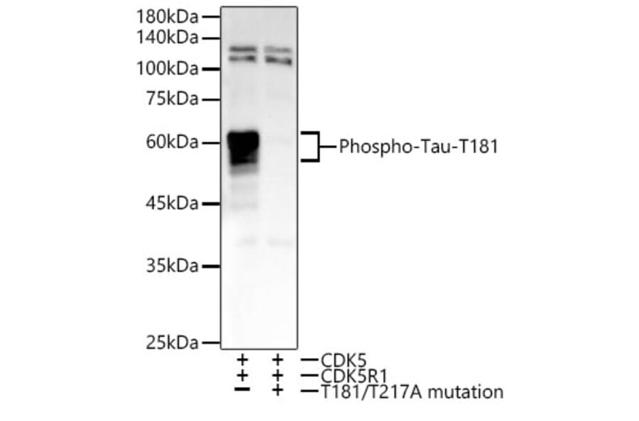 Western Blot - Anti-Tau (phospho Thr181) Antibody [ARC54951] (A308181) - Antibodies.com