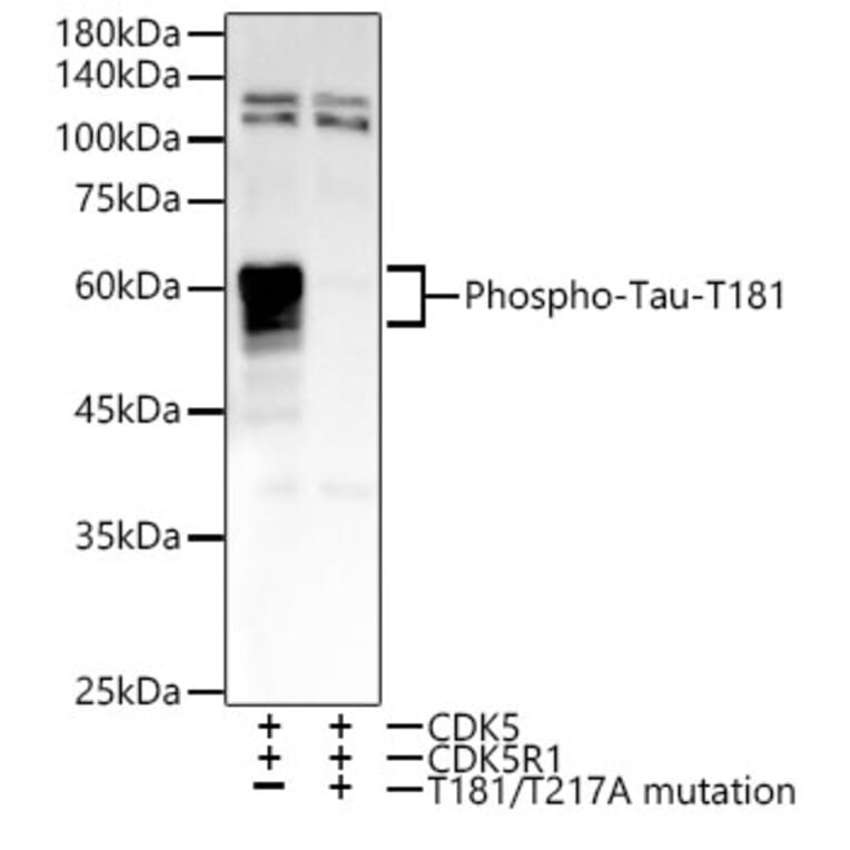 Western Blot - Anti-Tau (phospho Thr181) Antibody [ARC54951] (A308181) - Antibodies.com