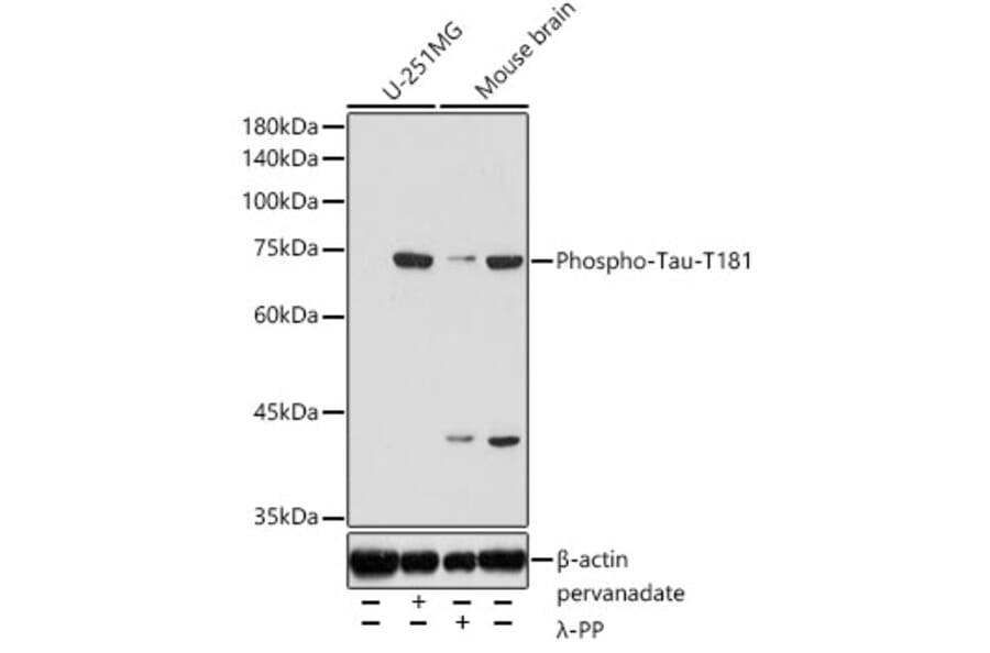 Western Blot - Anti-Tau (phospho Thr181) Antibody (A308182) - Antibodies.com