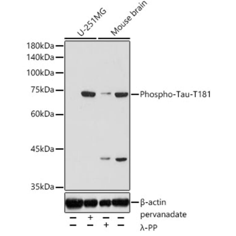 Western Blot - Anti-Tau (phospho Thr181) Antibody (A308182) - Antibodies.com