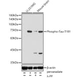 Western Blot - Anti-Tau (phospho Thr181) Antibody (A308182) - Antibodies.com