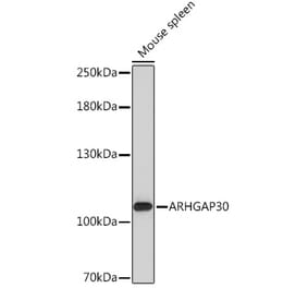 Western Blot - Anti-ARHGAP30 Antibody (A308183) - Antibodies.com