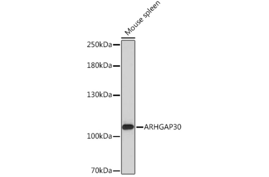 Western Blot - Anti-ARHGAP30 Antibody (A308183) - Antibodies.com