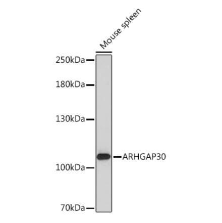 Western Blot - Anti-ARHGAP30 Antibody (A308183) - Antibodies.com