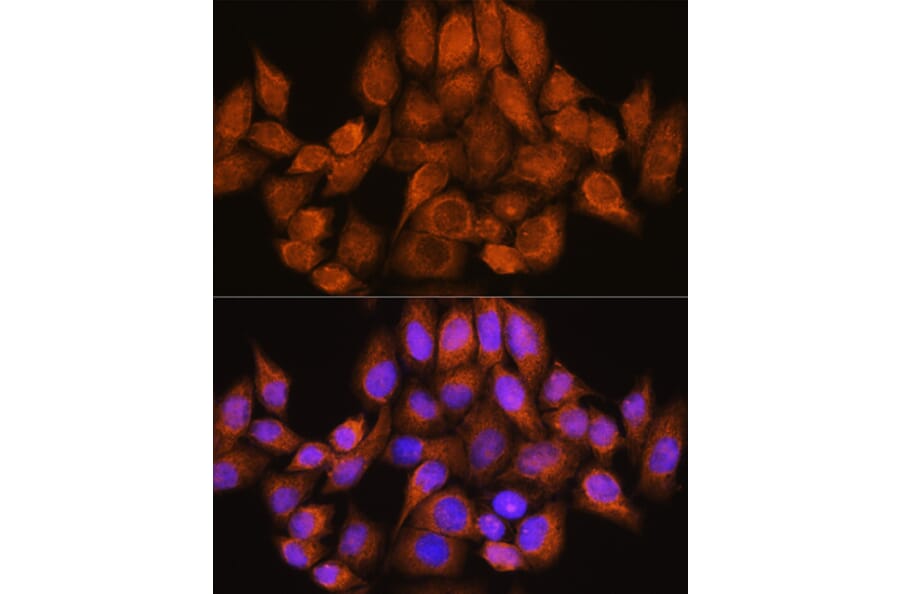 Immunofluorescence - Anti-ARHGAP30 Antibody (A308183) - Antibodies.com