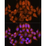 Immunofluorescence - Anti-ARHGAP30 Antibody (A308183) - Antibodies.com