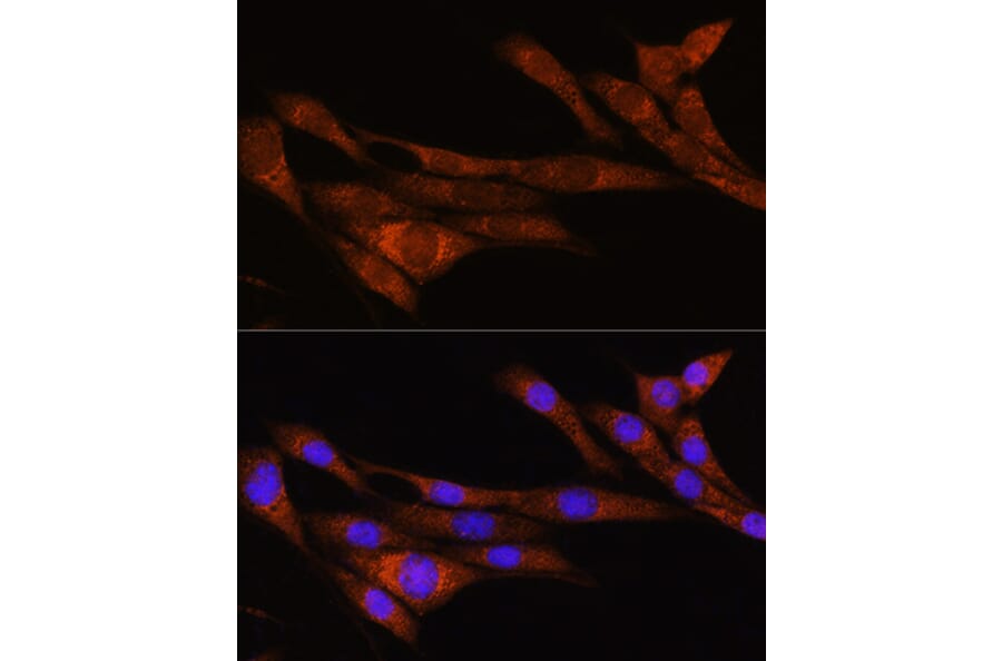 Immunofluorescence - Anti-ARHGAP30 Antibody (A308183) - Antibodies.com