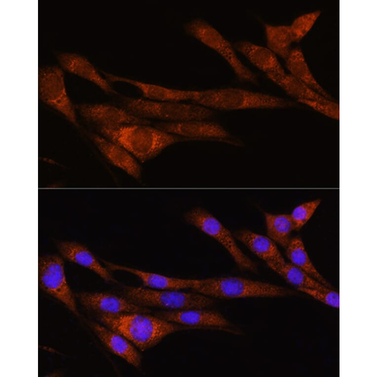 Immunofluorescence - Anti-ARHGAP30 Antibody (A308183) - Antibodies.com