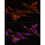 Immunofluorescence - Anti-ARHGAP30 Antibody (A308183) - Antibodies.com
