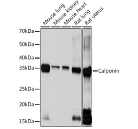 Western Blot - Anti-Calponin 1 Antibody [ARC0232] (A308184) - Antibodies.com