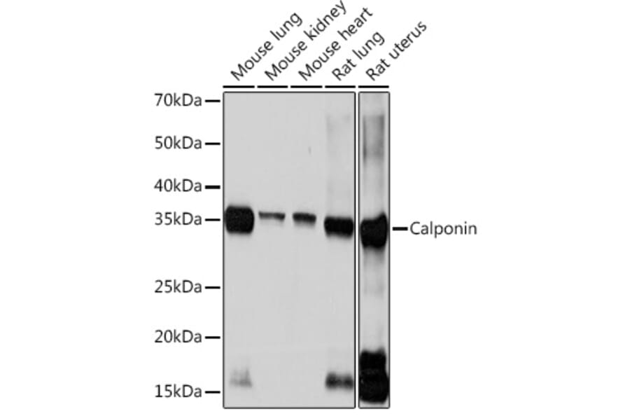 Western Blot - Anti-Calponin 1 Antibody [ARC0232] (A308184) - Antibodies.com
