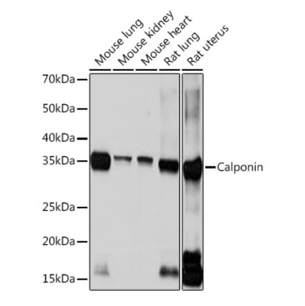 Western Blot - Anti-Calponin 1 Antibody [ARC0232] (A308184) - Antibodies.com