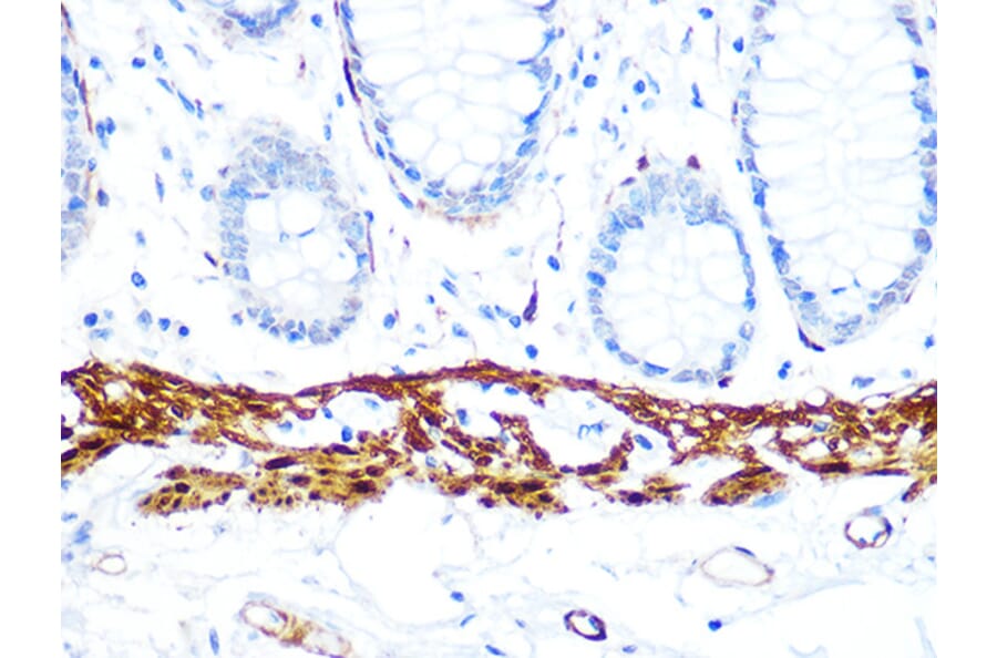 Immunohistochemistry - Anti-Calponin 1 Antibody [ARC0232] (A308184) - Antibodies.com