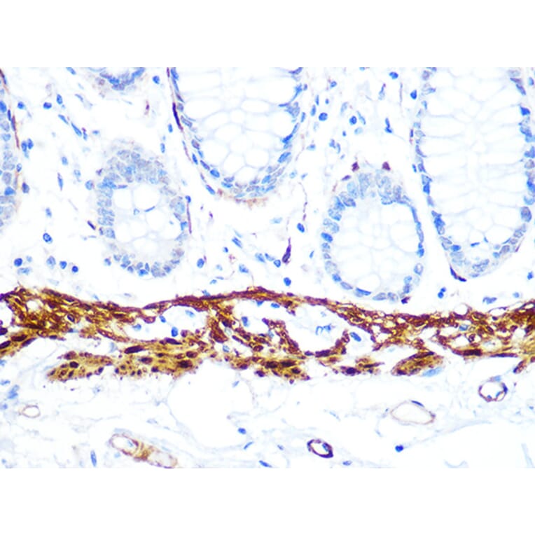 Immunohistochemistry - Anti-Calponin 1 Antibody [ARC0232] (A308184) - Antibodies.com