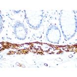 Immunohistochemistry - Anti-Calponin 1 Antibody [ARC0232] (A308184) - Antibodies.com