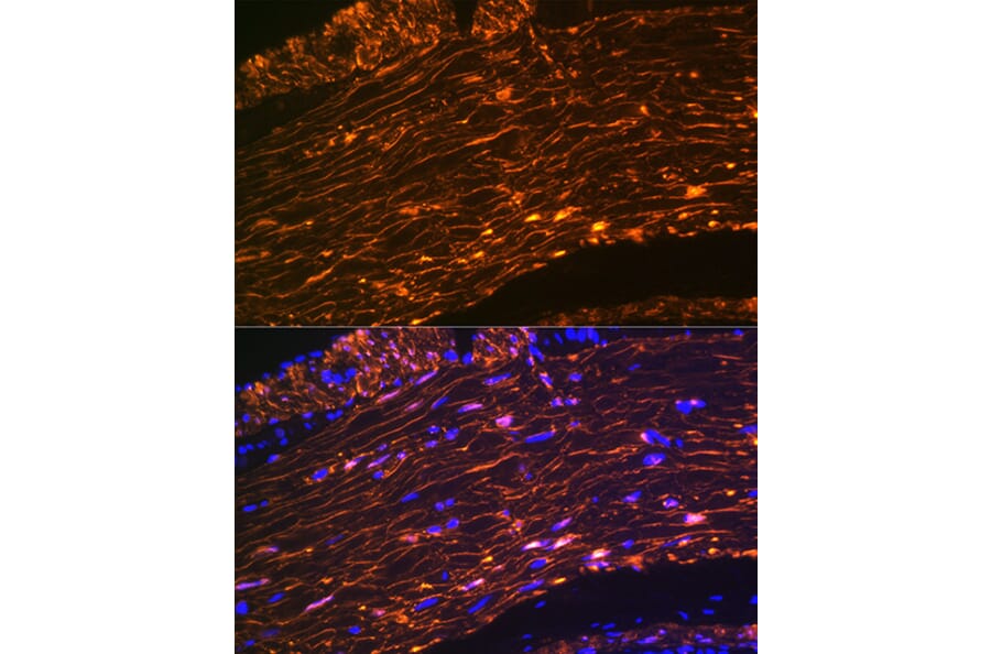 Immunofluorescence - Anti-Calponin 1 Antibody [ARC0232] (A308184) - Antibodies.com