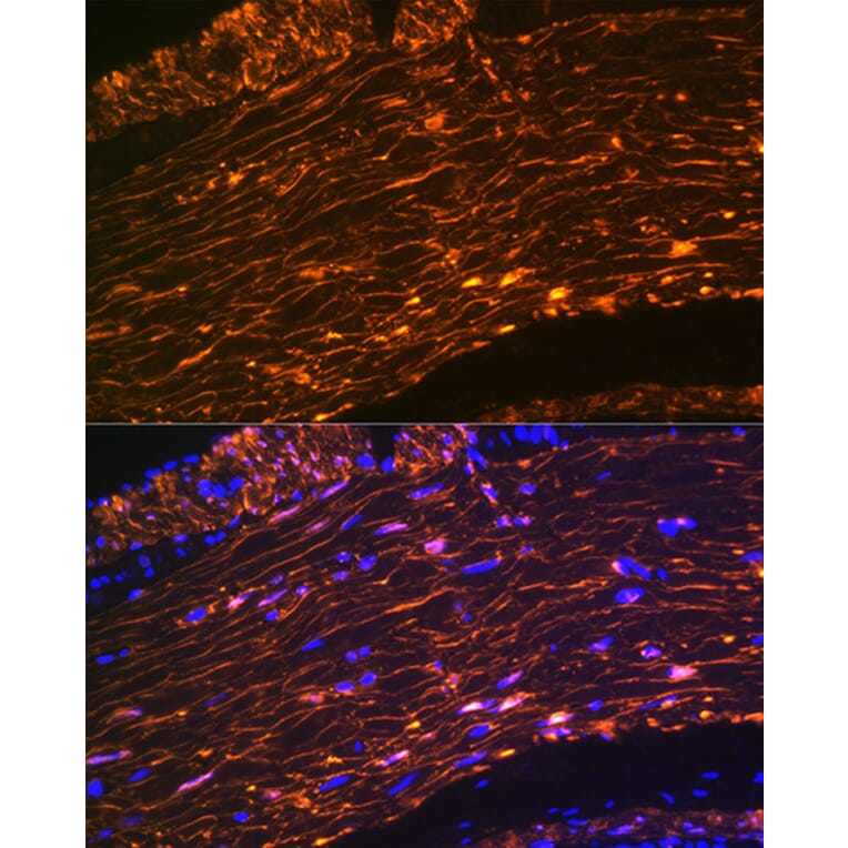 Immunofluorescence - Anti-Calponin 1 Antibody [ARC0232] (A308184) - Antibodies.com