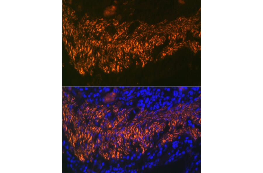 Immunofluorescence - Anti-Calponin 1 Antibody [ARC0232] (A308184) - Antibodies.com