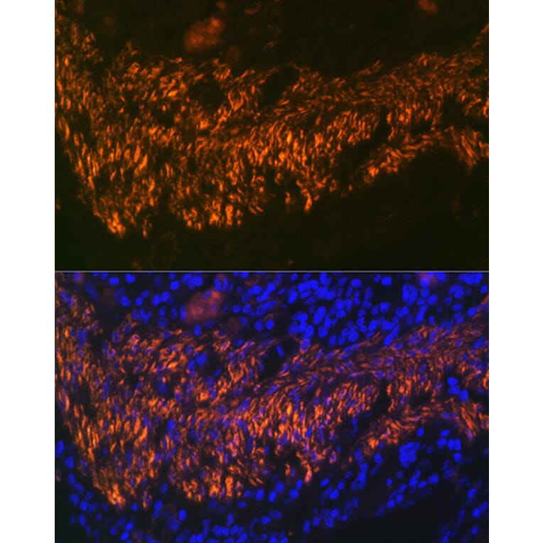 Immunofluorescence - Anti-Calponin 1 Antibody [ARC0232] (A308184) - Antibodies.com