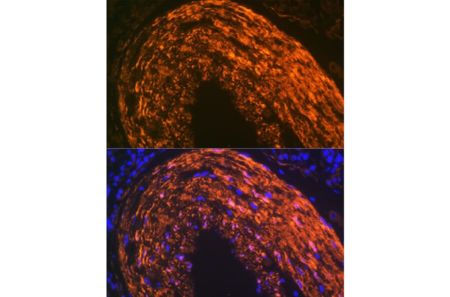 Immunofluorescence - Anti-Calponin 1 Antibody [ARC0232] (A308184) - Antibodies.com