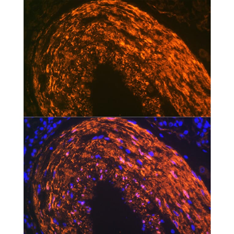 Immunofluorescence - Anti-Calponin 1 Antibody [ARC0232] (A308184) - Antibodies.com