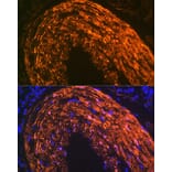 Immunofluorescence - Anti-Calponin 1 Antibody [ARC0232] (A308184) - Antibodies.com