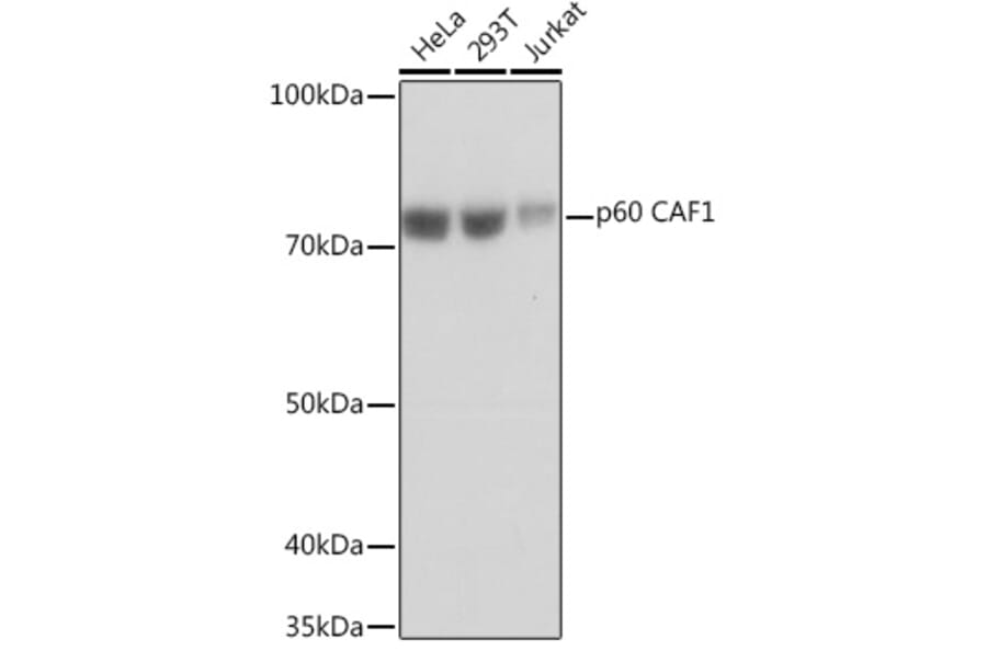 Western Blot - Anti-p60 CAF1/MPP7 Antibody [ARC1269] (A308188) - Antibodies.com