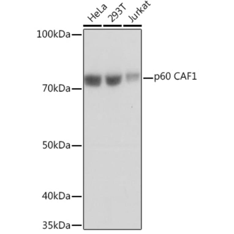 Western Blot - Anti-p60 CAF1/MPP7 Antibody [ARC1269] (A308188) - Antibodies.com
