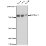 Western Blot - Anti-p60 CAF1/MPP7 Antibody [ARC1269] (A308188) - Antibodies.com