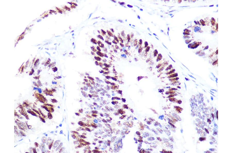 Immunohistochemistry - Anti-p60 CAF1/MPP7 Antibody [ARC1269] (A308188) - Antibodies.com