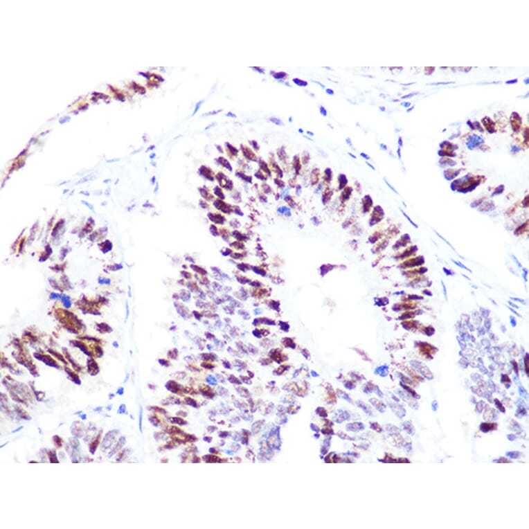 Immunohistochemistry - Anti-p60 CAF1/MPP7 Antibody [ARC1269] (A308188) - Antibodies.com