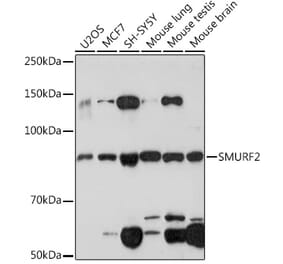 Western Blot - Anti-SMURF 2 Antibody [ARC1897] (A308190) - Antibodies.com