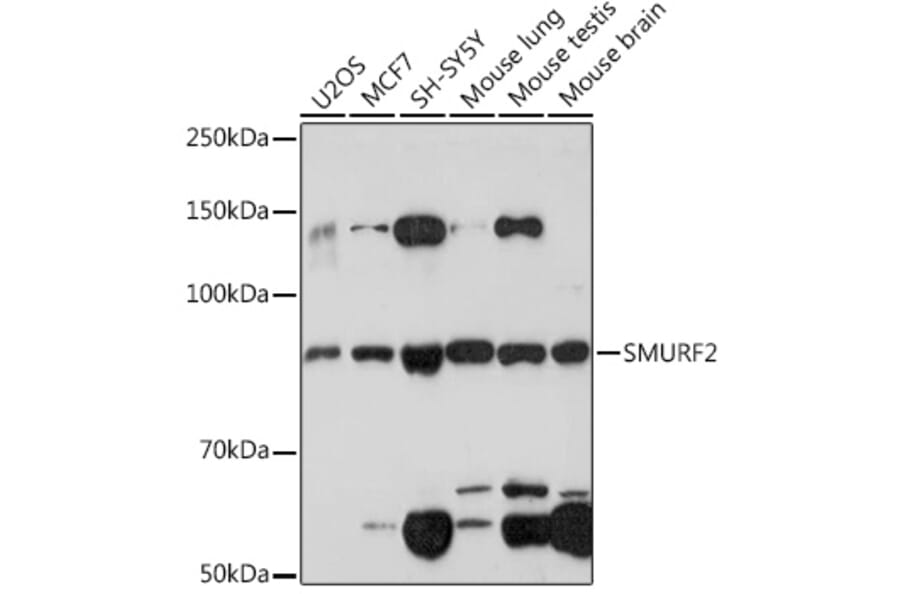 Western Blot - Anti-SMURF 2 Antibody [ARC1897] (A308190) - Antibodies.com